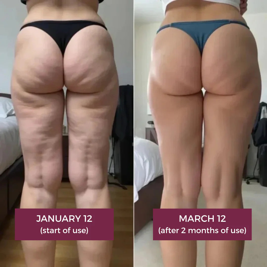 3D Sculpting Anti-Cellulite Leggings