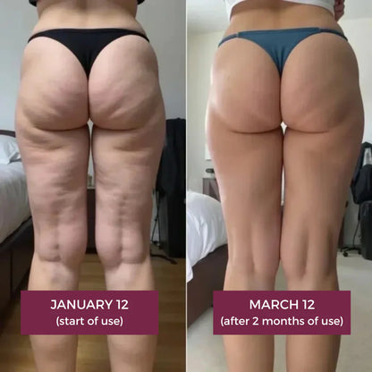 3D Sculpting Anti-Cellulite Leggings