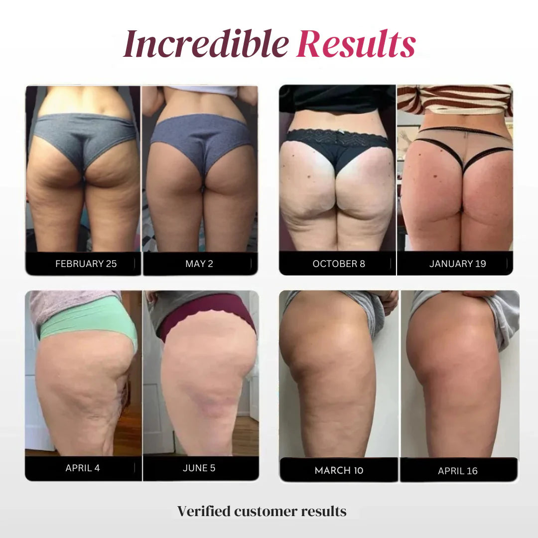 3D Sculpting Anti-Cellulite Leggings