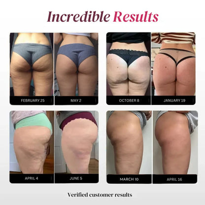 3D Sculpting Anti-Cellulite Leggings